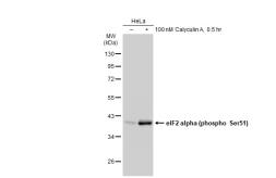 Anti-eIF2 alpha (phospho Ser51) antibody [GT1203] used in Western Blot (WB). GTX00965
